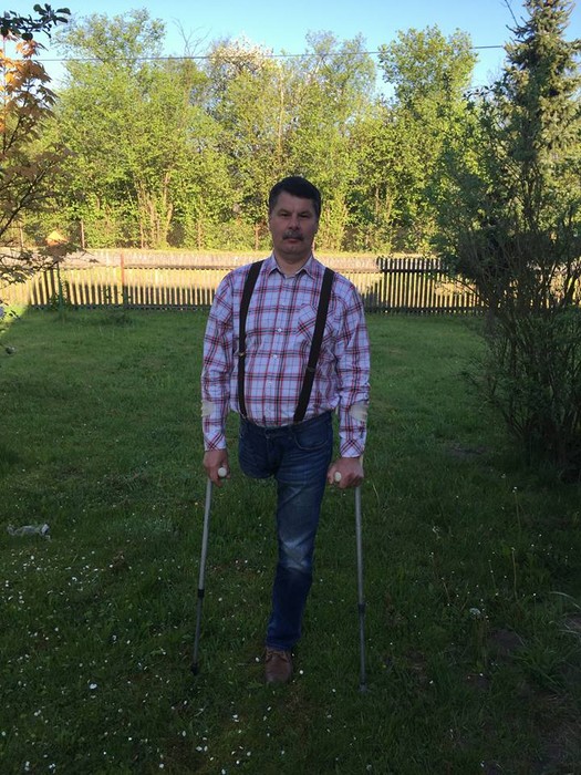 Arek z Oksy potrzebuje pomocy. Trwa zbiórka na protezę nogi