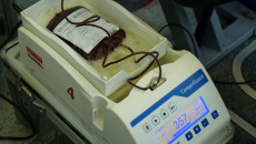 Specjalistyczne Urządzenie Medyczne Na Którym Leży Worek Plastikowy Wypełniony Krwią